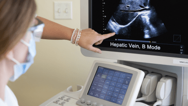 someone pointing to ultra sound screen that says hepatic vein, b mode